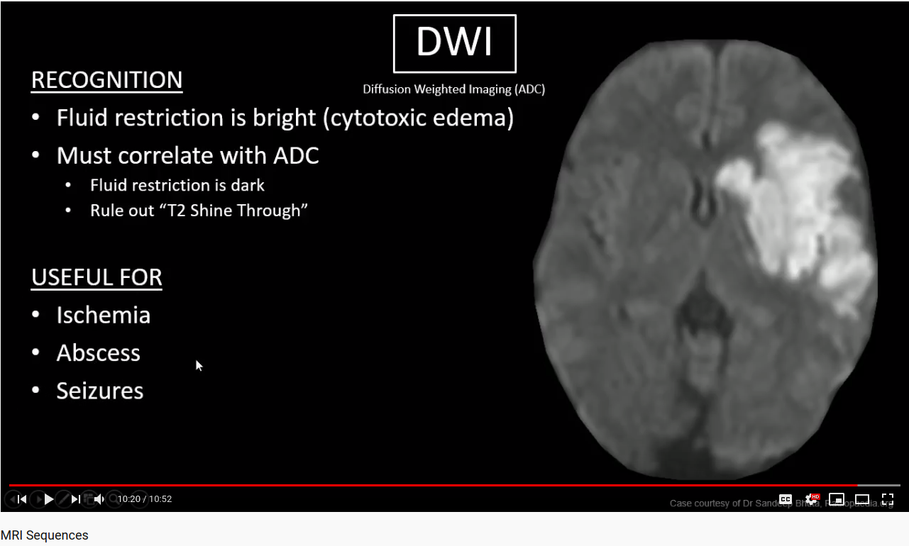 DWI-MRI